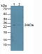 Proteasome 26S Subunit, Non-ATPase 10 antibody, LS-C315048, Lifespan Biosciences, Western Blot image 