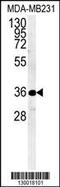 Myozenin 1 antibody, 61-856, ProSci, Western Blot image 