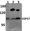 Ubiquitin Specific Peptidase 37 antibody, PA5-75942, Invitrogen Antibodies, Western Blot image 