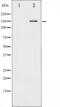 c-met antibody, abx011907, Abbexa, Western Blot image 