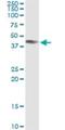 ADP-Ribosyltransferase 3 antibody, H00000419-M09, Novus Biologicals, Immunoprecipitation image 