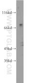 Zinc Finger Protein 699 antibody, 21562-1-AP, Proteintech Group, Western Blot image 