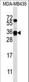 Casein Beta antibody, LS-C167090, Lifespan Biosciences, Western Blot image 