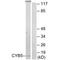 Cytochrome B5 Type A antibody, A04464, Boster Biological Technology, Western Blot image 