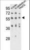 Methyl-CpG Binding Protein 2 antibody, LS-C98528, Lifespan Biosciences, Western Blot image 