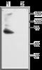 Potassium Voltage-Gated Channel Subfamily D Member 2 antibody, GTX54838, GeneTex, Western Blot image 