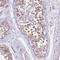 Cytochrome C Oxidase Copper Chaperone COX17 antibody, HPA048158, Atlas Antibodies, Immunohistochemistry paraffin image 