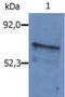 BLNK antibody, PA1-19377, Invitrogen Antibodies, Western Blot image 