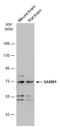 Sterile Alpha And TIR Motif Containing 1 antibody, OAGA07948, Aviva Systems Biology, Western Blot image 