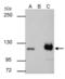 Poly(ADP-Ribose) Polymerase 1 antibody, GTX112864, GeneTex, Immunoprecipitation image 