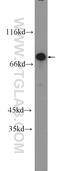 Zinc Finger Protein 326 antibody, 25147-1-AP, Proteintech Group, Western Blot image 