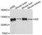 Insulin-degrading enzyme antibody, A11809, ABclonal Technology, Western Blot image 