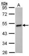 Betaine--Homocysteine S-Methyltransferase antibody, GTX102983, GeneTex, Western Blot image 