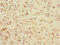 TPPP antibody, LS-C676628, Lifespan Biosciences, Immunohistochemistry paraffin image 