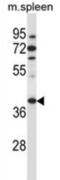 Tubulin-specific chaperone C antibody, abx027410, Abbexa, Western Blot image 