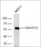 Polypeptide N-Acetylgalactosaminyltransferase 12 antibody, orb157031, Biorbyt, Western Blot image 