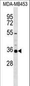 Potassium Voltage-Gated Channel Subfamily A Member 5 antibody, LS-C165411, Lifespan Biosciences, Western Blot image 