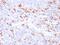 S100 Calcium Binding Protein A8 antibody, GTX02753, GeneTex, Immunohistochemistry paraffin image 