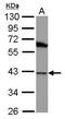 DnaJ Heat Shock Protein Family (Hsp40) Member B1 antibody, GTX102049, GeneTex, Western Blot image 