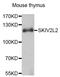 Mtr4 Exosome RNA Helicase antibody, LS-C333418, Lifespan Biosciences, Western Blot image 