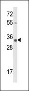 Calponin 3 antibody, MBS9214202, MyBioSource, Western Blot image 