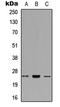 Ring Finger Protein 125 antibody, LS-C358283, Lifespan Biosciences, Western Blot image 