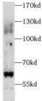 Phosphatidylinositol Glycan Anchor Biosynthesis Class Z antibody, FNab06447, FineTest, Western Blot image 