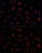 Frataxin antibody, GTX54036, GeneTex, Immunofluorescence image 