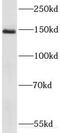 RecQ Like Helicase 4 antibody, FNab07226, FineTest, Western Blot image 