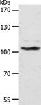 ADAM Metallopeptidase With Thrombospondin Type 1 Motif 17 antibody, PA5-50599, Invitrogen Antibodies, Western Blot image 