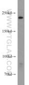 URB1 Ribosome Biogenesis Homolog antibody, 20023-1-AP, Proteintech Group, Western Blot image 