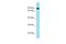 Chromosome 10 Open Reading Frame 120 antibody, A19022, Boster Biological Technology, Western Blot image 