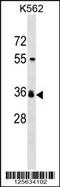 Solute Carrier Family 25 Member 2 antibody, 59-691, ProSci, Western Blot image 