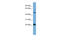 Hemogen antibody, ARP57794_P050, Aviva Systems Biology, Western Blot image 
