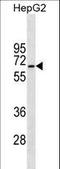 Serine/Threonine Kinase 39 antibody, LS-C161568, Lifespan Biosciences, Western Blot image 