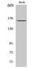 BCR Activator Of RhoGEF And GTPase antibody, A00022Y177, Boster Biological Technology, Western Blot image 