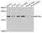 Eukaryotic Translation Initiation Factor 1A X-Linked antibody, STJ27713, St John