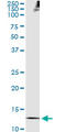 Thioredoxin antibody, LS-B14152, Lifespan Biosciences, Immunoprecipitation image 