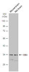 Microtubule Associated Protein RP/EB Family Member 3 antibody, GTX115652, GeneTex, Western Blot image 