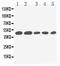 Interleukin 2 Receptor Subunit Gamma antibody, PA1616, Boster Biological Technology, Western Blot image 