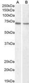 Lamin B1 antibody, 43-160, ProSci, Enzyme Linked Immunosorbent Assay image 