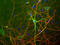 Neurofilament Light antibody, LS-C204557, Lifespan Biosciences, Immunocytochemistry image 