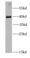 Hypoxia Inducible Factor 1 Subunit Alpha Inhibitor antibody, FNab03860, FineTest, Western Blot image 