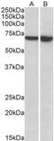 Lymphocyte Cytosolic Protein 1 antibody, MBS423297, MyBioSource, Western Blot image 