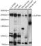 SPT6 Homolog, Histone Chaperone And Transcription Elongation Factor antibody, A06484, Boster Biological Technology, Western Blot image 