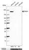 Protein LAP2 antibody, NBP2-56104, Novus Biologicals, Western Blot image 