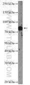 L3MBTL Histone Methyl-Lysine Binding Protein 4 antibody, 26280-1-AP, Proteintech Group, Western Blot image 