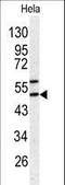 Serpin Family H Member 1 antibody, LS-C100548, Lifespan Biosciences, Western Blot image 