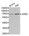 Estrogen Receptor 2 antibody, LS-C332153, Lifespan Biosciences, Western Blot image 