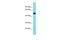 Transmembrane Protein 39A antibody, A14185, Boster Biological Technology, Western Blot image 